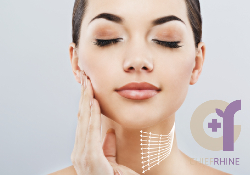 圖為女性臉部拉提效果示意，埋線拉提可透過線材支撐鬆弛肌膚，並刺激膠原蛋白增生。